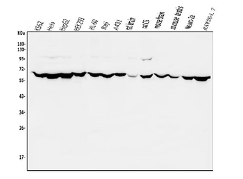 PIAS2 Rabbit Polyclonal Antibody