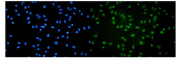 RNA polymerase II/POLR2A Rabbit Polyclonal Antibody
