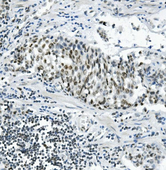 PRDM5 Rabbit Polyclonal Antibody