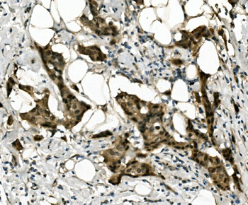 RBPMS Rabbit Polyclonal Antibody