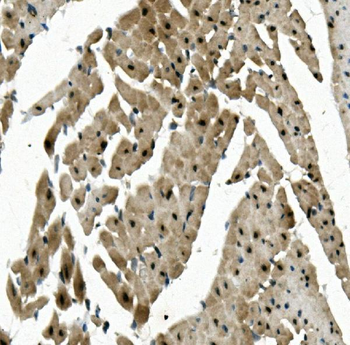 RBPMS Rabbit Polyclonal Antibody