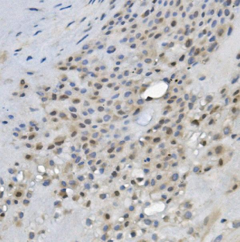 REC8 Rabbit Polyclonal Antibody