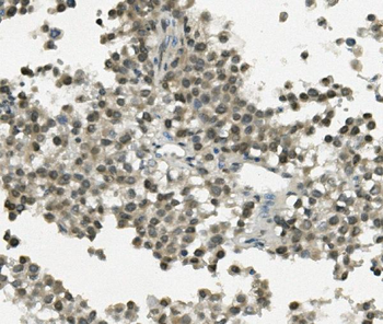 REC8 Rabbit Polyclonal Antibody