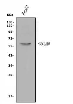 GLUT10/SLC2A10 Rabbit Polyclonal Antibody