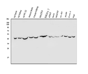 TXNIP Rabbit Polyclonal Antibody
