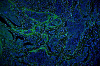 Vinculin/VCL Rabbit Polyclonal Antibody