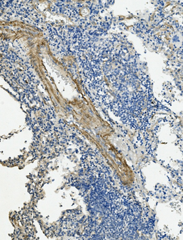 Vinculin/VCL Rabbit Polyclonal Antibody