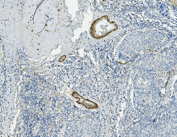 Vinculin/VCL Rabbit Polyclonal Antibody