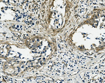 Vinculin/VCL Rabbit Polyclonal Antibody