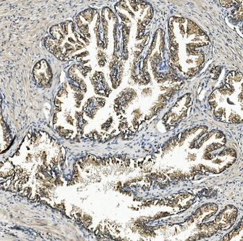 Rex1/ZFP42 Rabbit Polyclonal Antibody