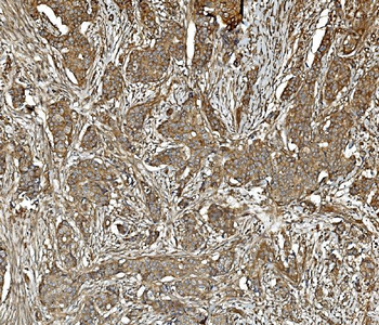 PP2A-alpha/PPP2CA/PP2A Mouse Monoclonal Antibody