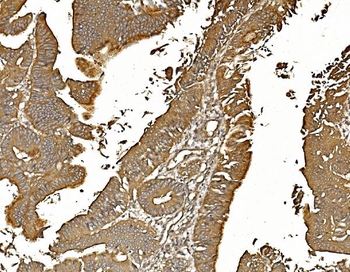PP2A-alpha/PPP2CA/PP2A Mouse Monoclonal Antibody
