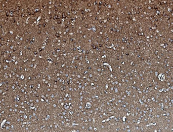 PP2A-alpha/PPP2CA/PP2A Mouse Monoclonal Antibody