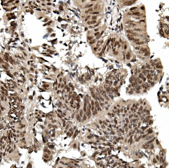 TIF1 gamma/TRIM33 Mouse Monoclonal Antibody