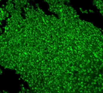 MCM2 Mouse Monoclonal Antibody