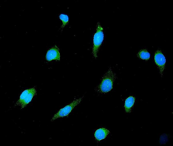 GAD65/GAD2 Mouse Monoclonal Antibody