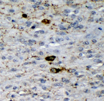 GAD65/GAD2 Mouse Monoclonal Antibody