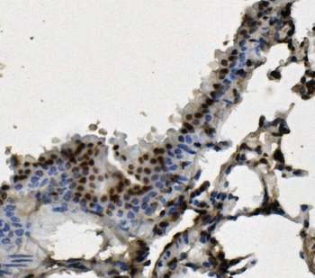 hnRNP D/AUF1/HNRNPD Mouse Monoclonal Antibody