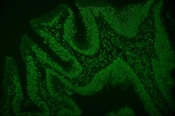 hnRNP D/AUF1/HNRNPD Mouse Monoclonal Antibody