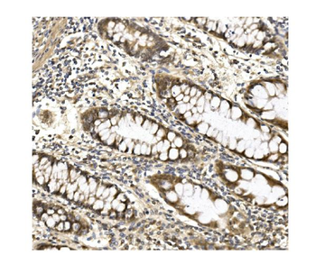 Aconitase 1/ACO1 Rabbit Polyclonal Antibody
