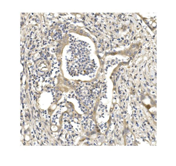 Aconitase 1/ACO1 Rabbit Polyclonal Antibody