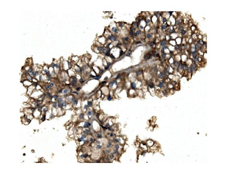 Aconitase 1/ACO1 Rabbit Polyclonal Antibody