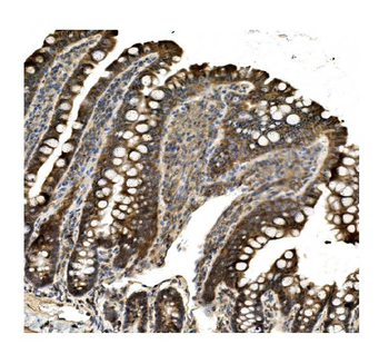 Aconitase 1/ACO1 Rabbit Polyclonal Antibody