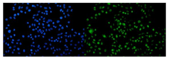 Arp2/ACTR2 Rabbit Polyclonal Antibody