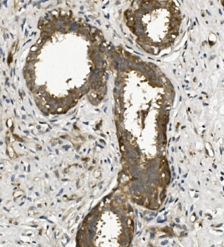 Arp2/ACTR2 Rabbit Polyclonal Antibody