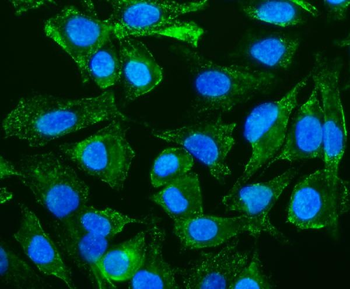 Caveolin-2/CAV2 Rabbit Polyclonal Antibody