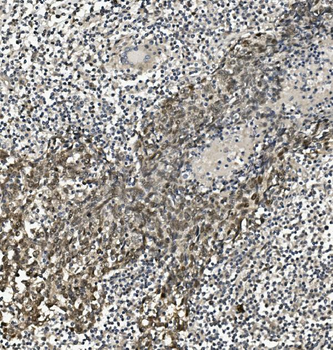 HP1 alpha/CBX5 Rabbit Polyclonal Antibody