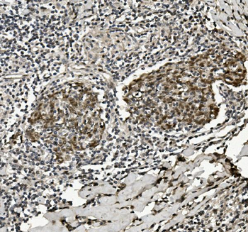 HP1 alpha/CBX5 Rabbit Polyclonal Antibody