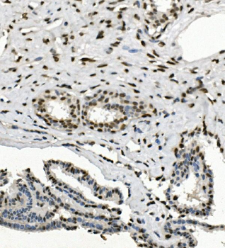 HP1 alpha/CBX5 Rabbit Polyclonal Antibody
