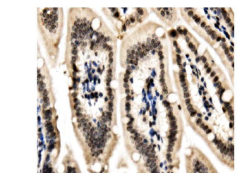 HP1 alpha/CBX5 Rabbit Polyclonal Antibody