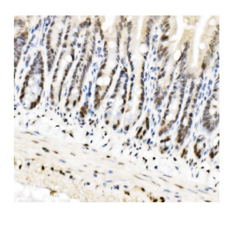 HP1 alpha/CBX5 Rabbit Polyclonal Antibody