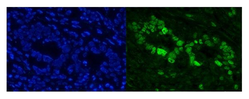 Cbx8 Rabbit Polyclonal Antibody