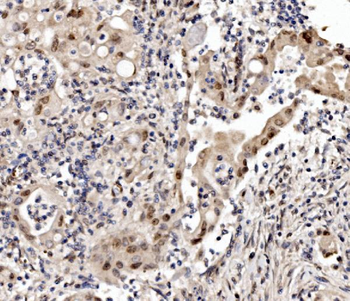 Cbx8 Rabbit Polyclonal Antibody