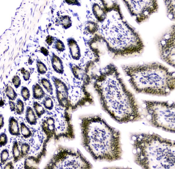 Cbx8 Rabbit Polyclonal Antibody