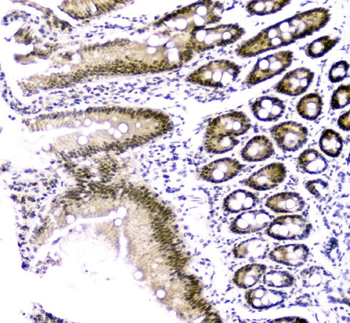 Cbx8 Rabbit Polyclonal Antibody