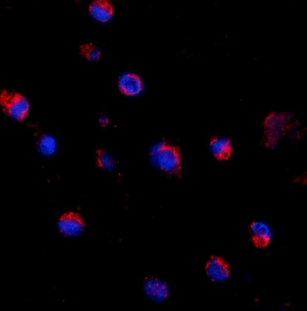 CD69 Rabbit Polyclonal Antibody