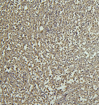CD69 Rabbit Polyclonal Antibody
