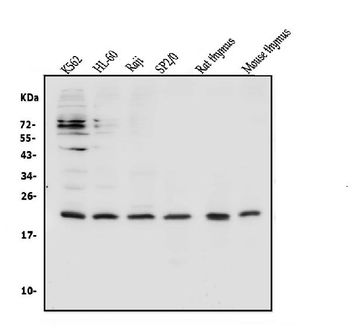 CD69 Rabbit Polyclonal Antibody