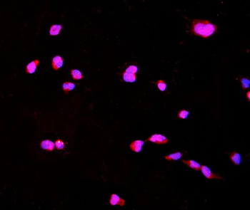 CTHRC1 Rabbit Polyclonal Antibody