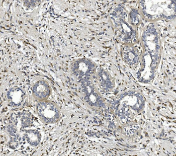 CTHRC1 Rabbit Polyclonal Antibody
