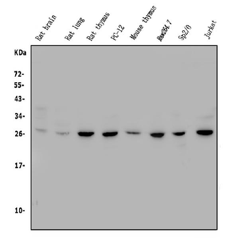 CTHRC1 Rabbit Polyclonal Antibody