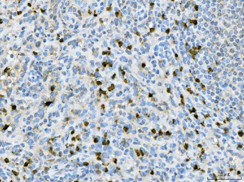CXCR2 Rabbit Polyclonal Antibody
