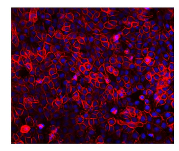 EGFR Rabbit Polyclonal Antibody