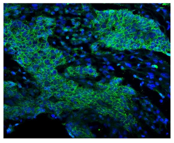 EGFR Rabbit Polyclonal Antibody