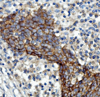 EGFR Rabbit Polyclonal Antibody