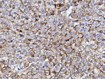 EGFR Rabbit Polyclonal Antibody